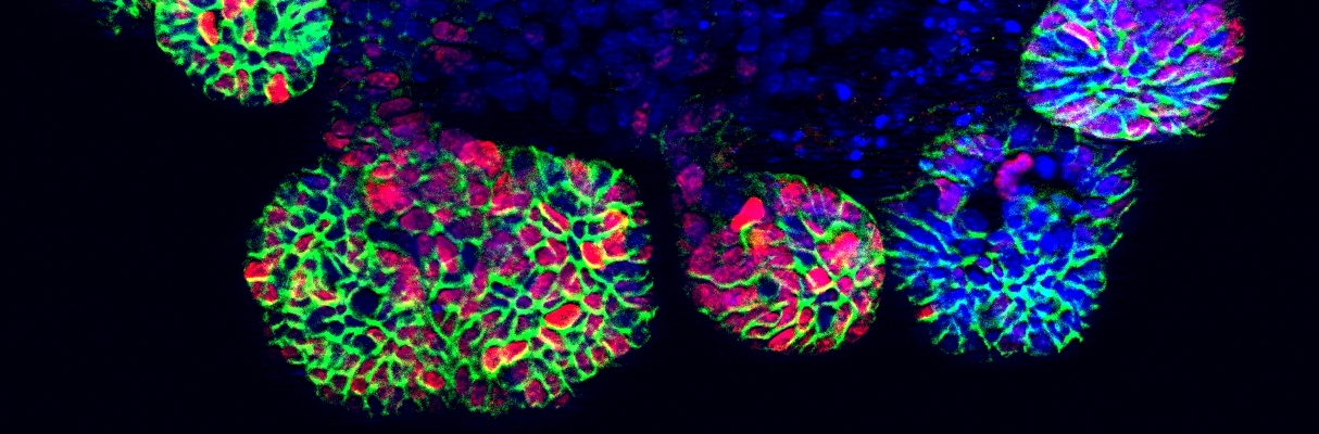 Small intestinal organoids by Thierry Jarde